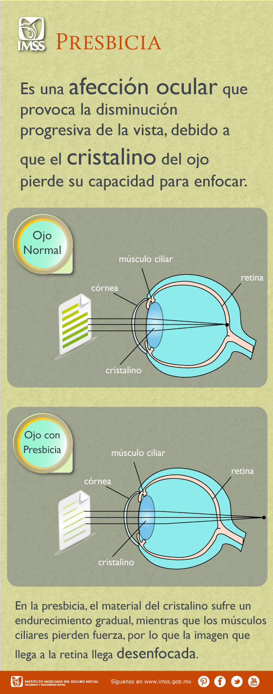 Presbicia ocular online