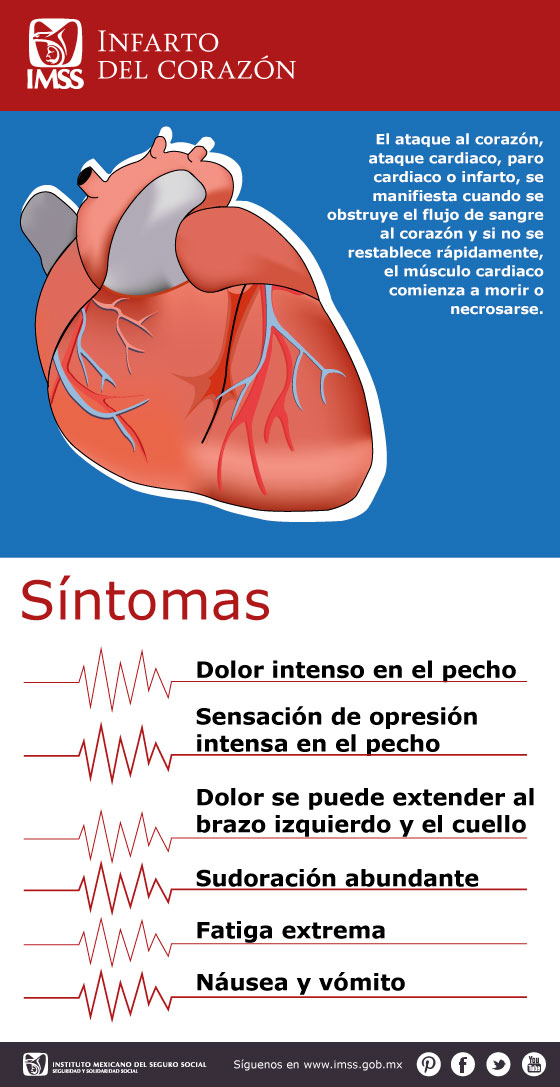 Infarto del corazón